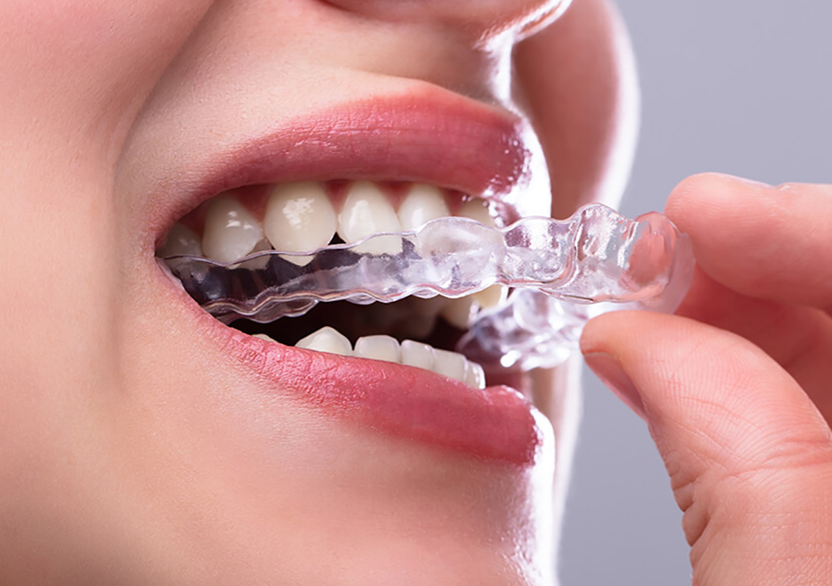 Clear Invisalign aligner being held up beside a set of traditional metal braces