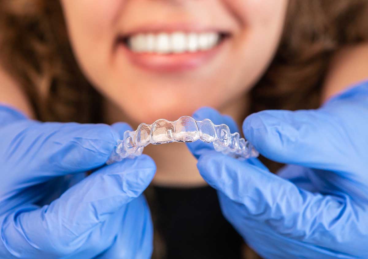 Invisalign clear aligner treatment for straightening teeth discreetly in West London