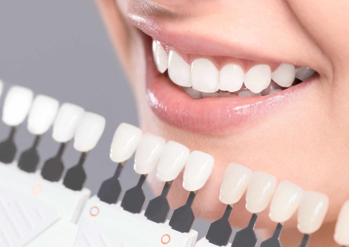 A bright smile compared against a tooth shade guide